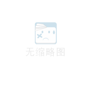 Points for Attention in Handling Centralized Dust Removal Equipment